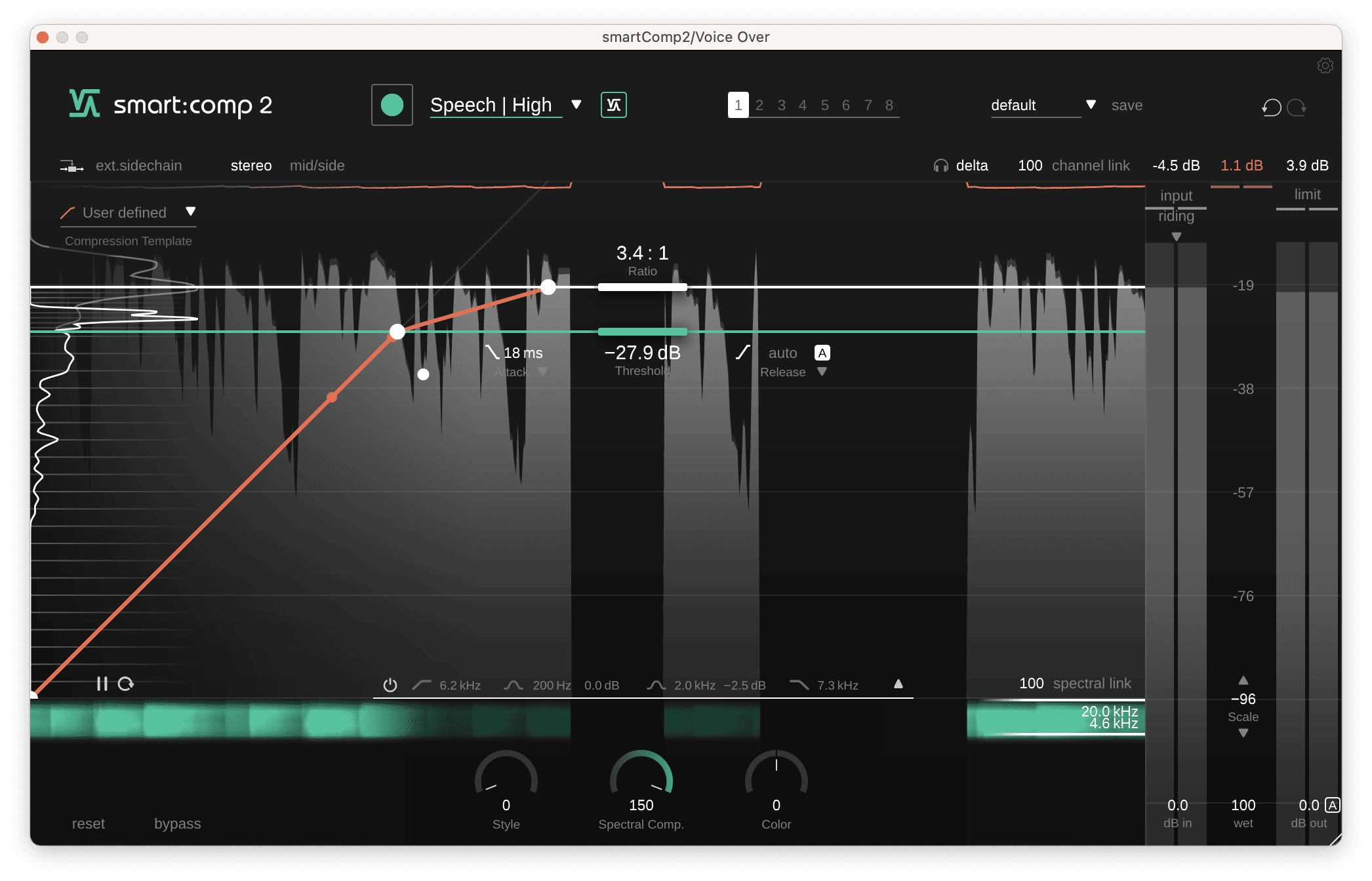 de-essing with smart:comp 2
